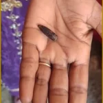 Haryana Woman Discovers SLR Bullet Inside Her Body After 20 Years