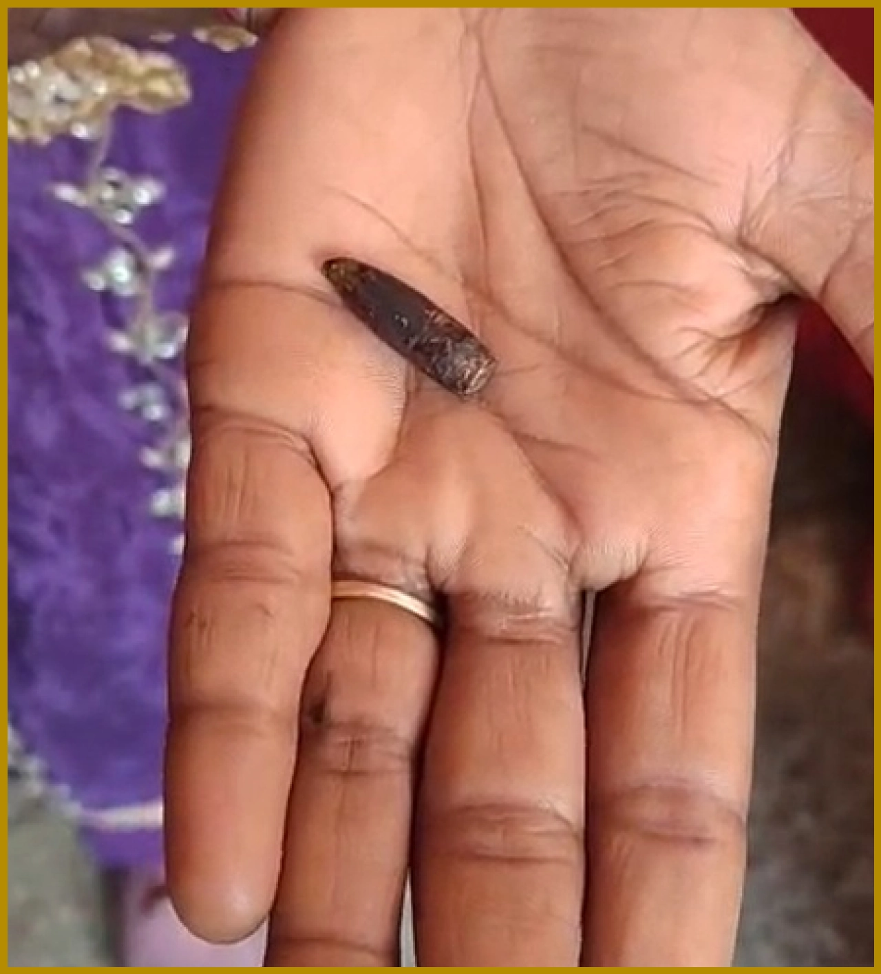 Haryana Woman Discovers SLR Bullet Inside Her Body After 20 Years